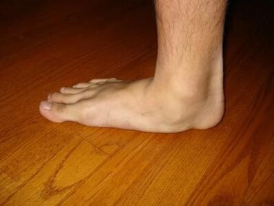 Opasnost od deformacije