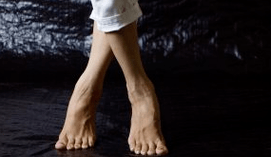 Deformacija valgusa